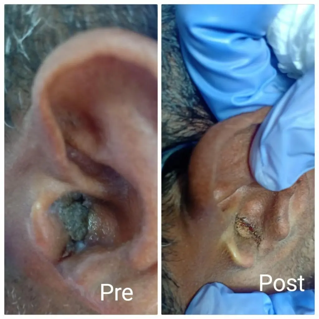 Ear fish eye treatment in Hurghada