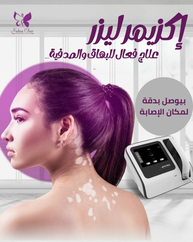 إكزايمر ليزر