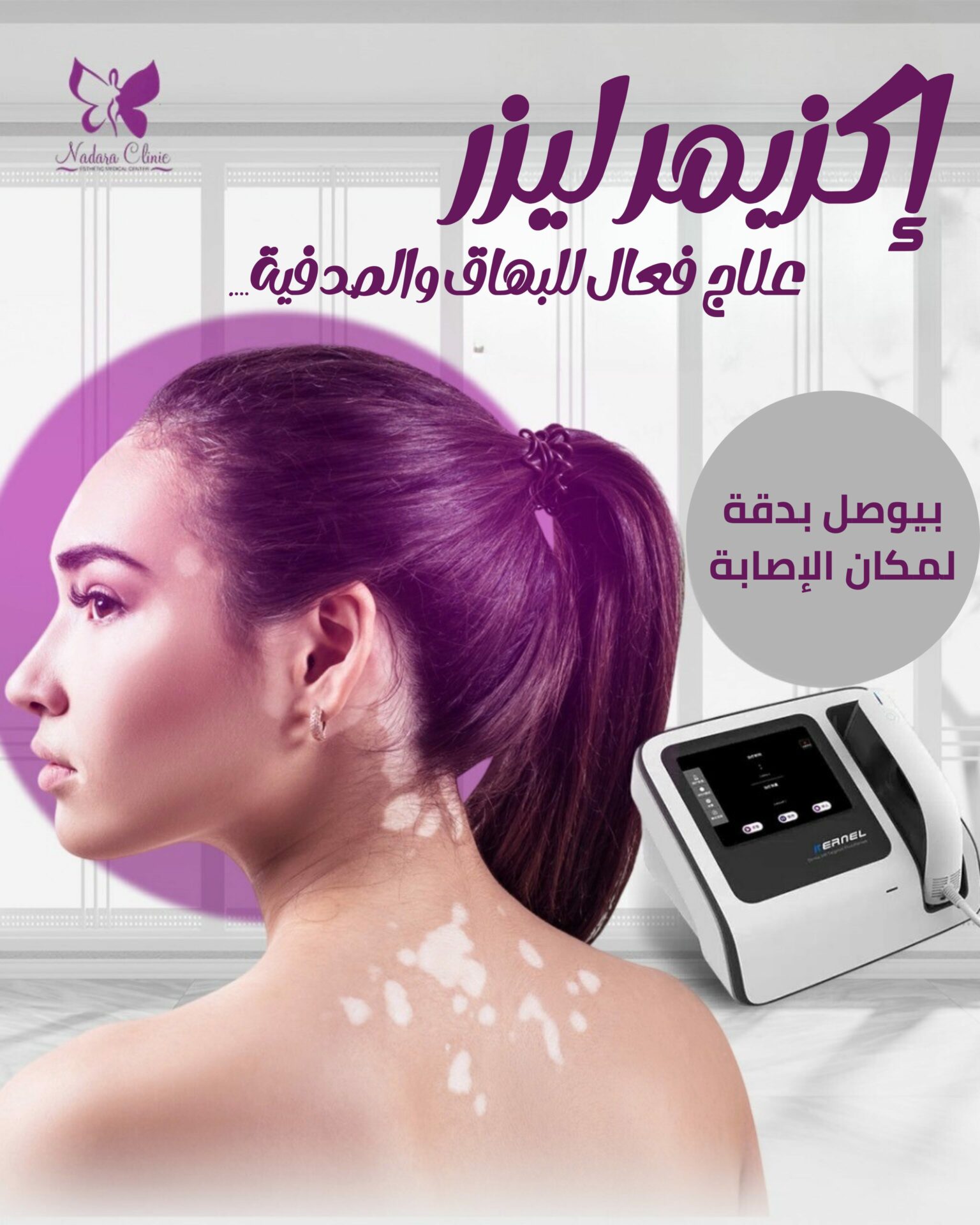 إكزايمر ليزر