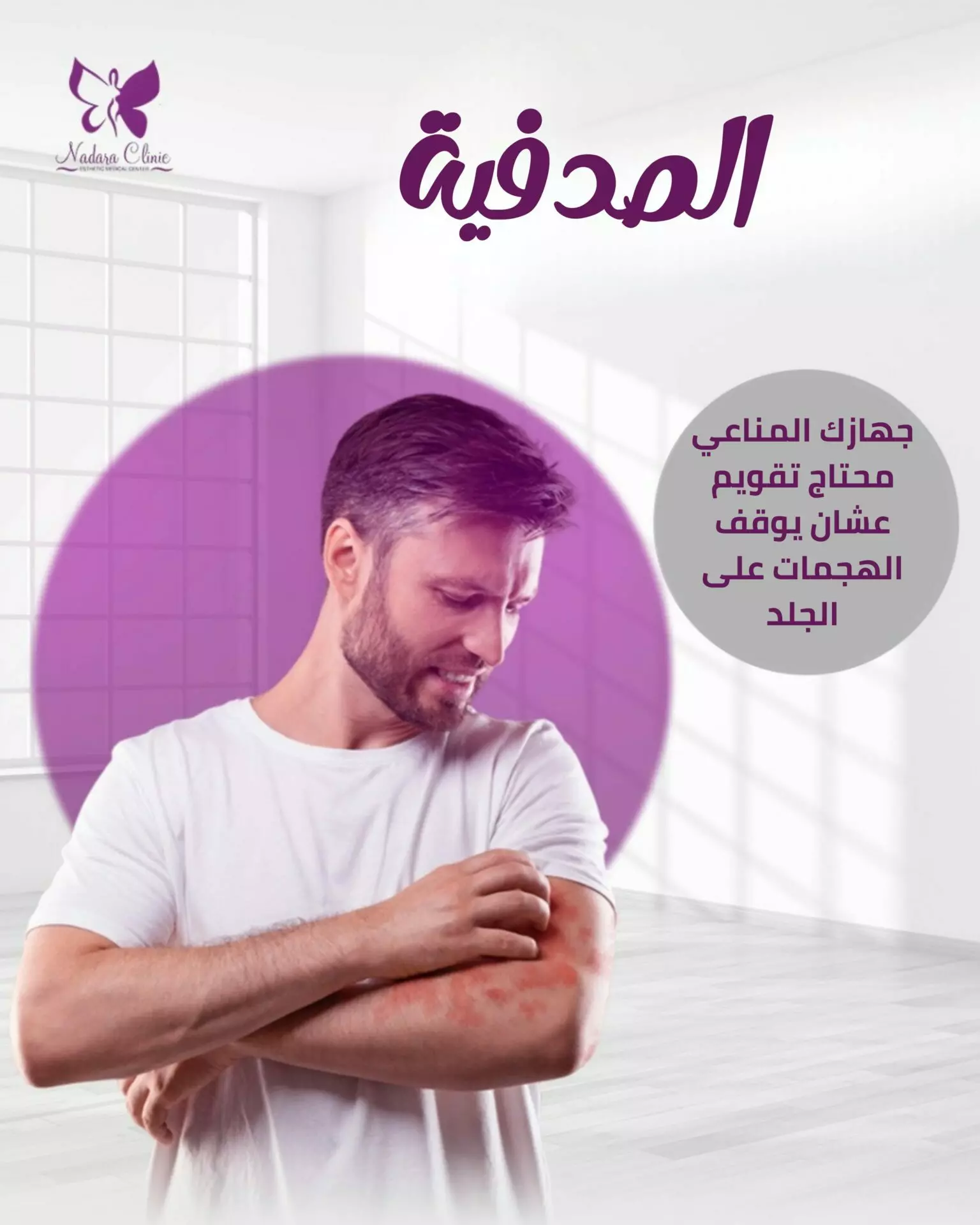 مرض الصدفية