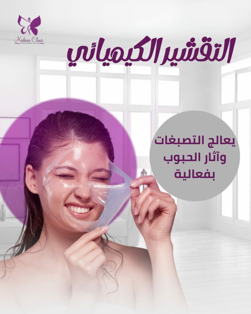 التقشير الكيميائي
