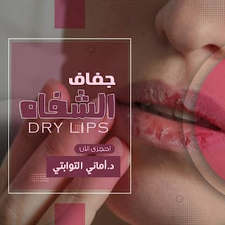 dry lips
