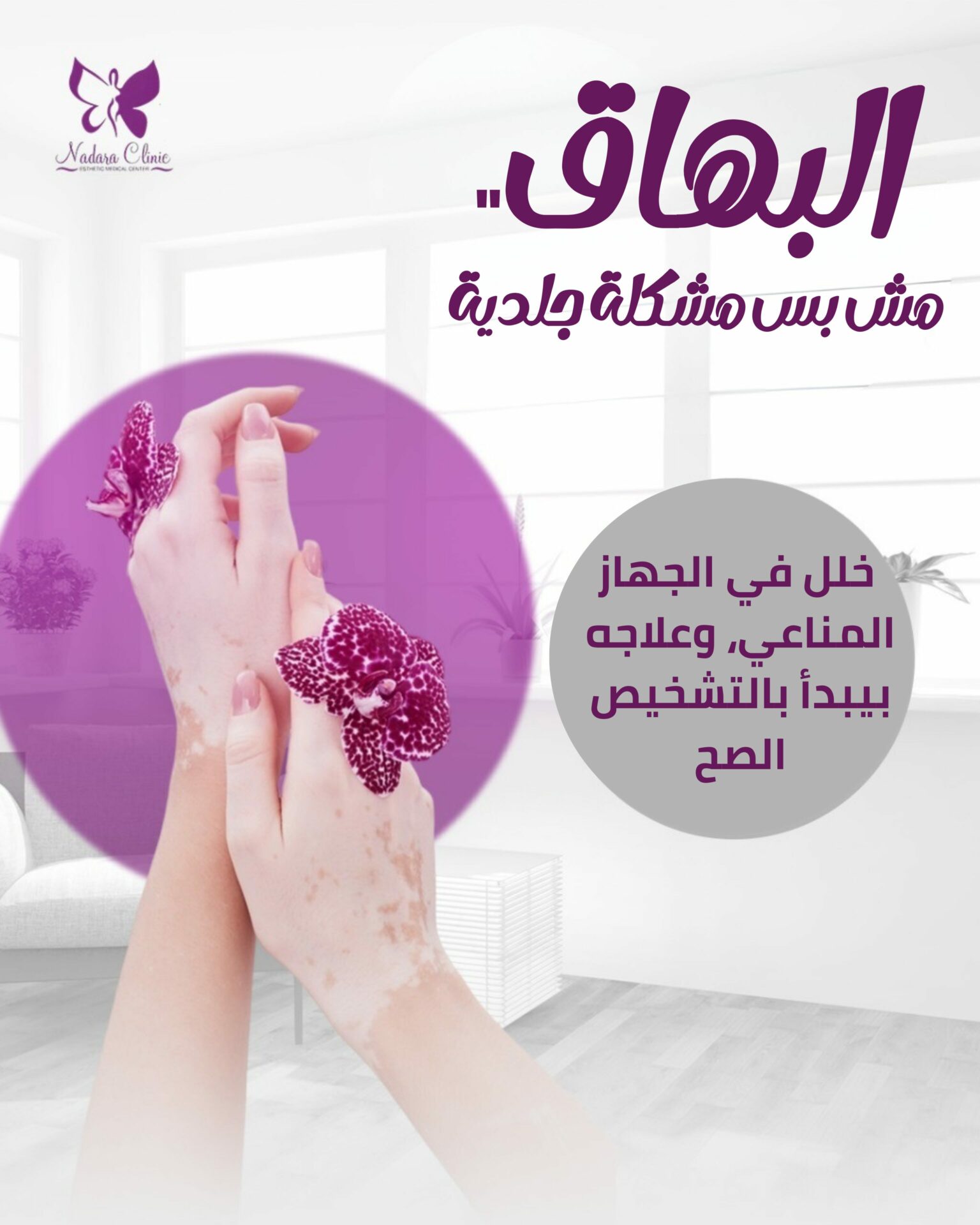 علاج البهاق