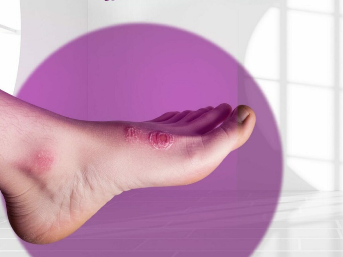 Diabetic foot - freshness center for dermatology, laser and cosmetology in  Hurghada, image size:1200x900