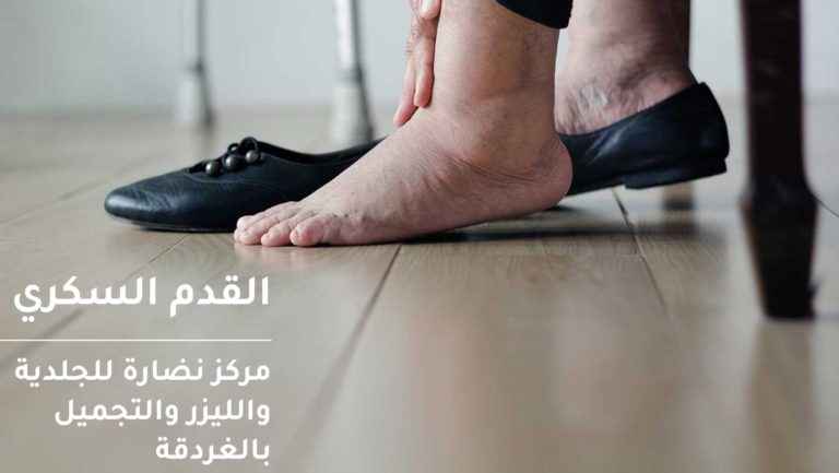 diabetic foot