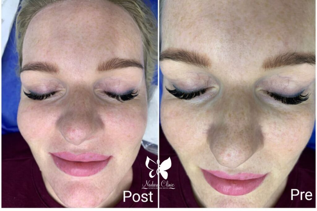 تنظيف البشرة العميق