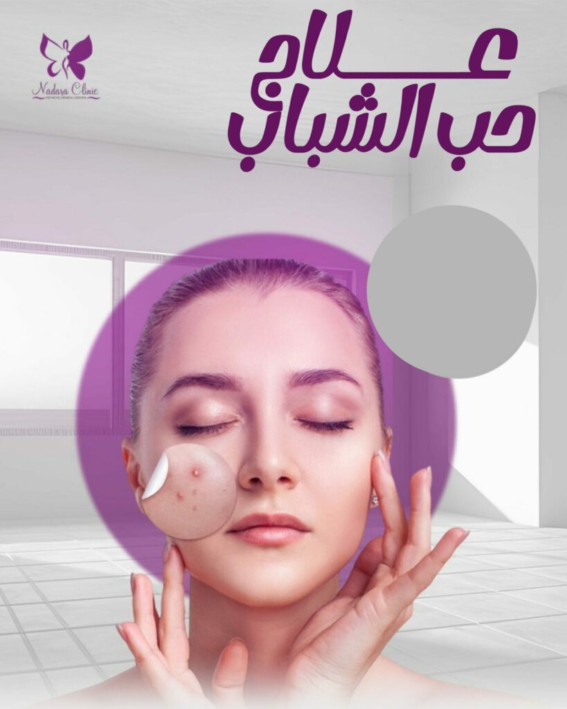 علاج حب الشباب في الغردقة