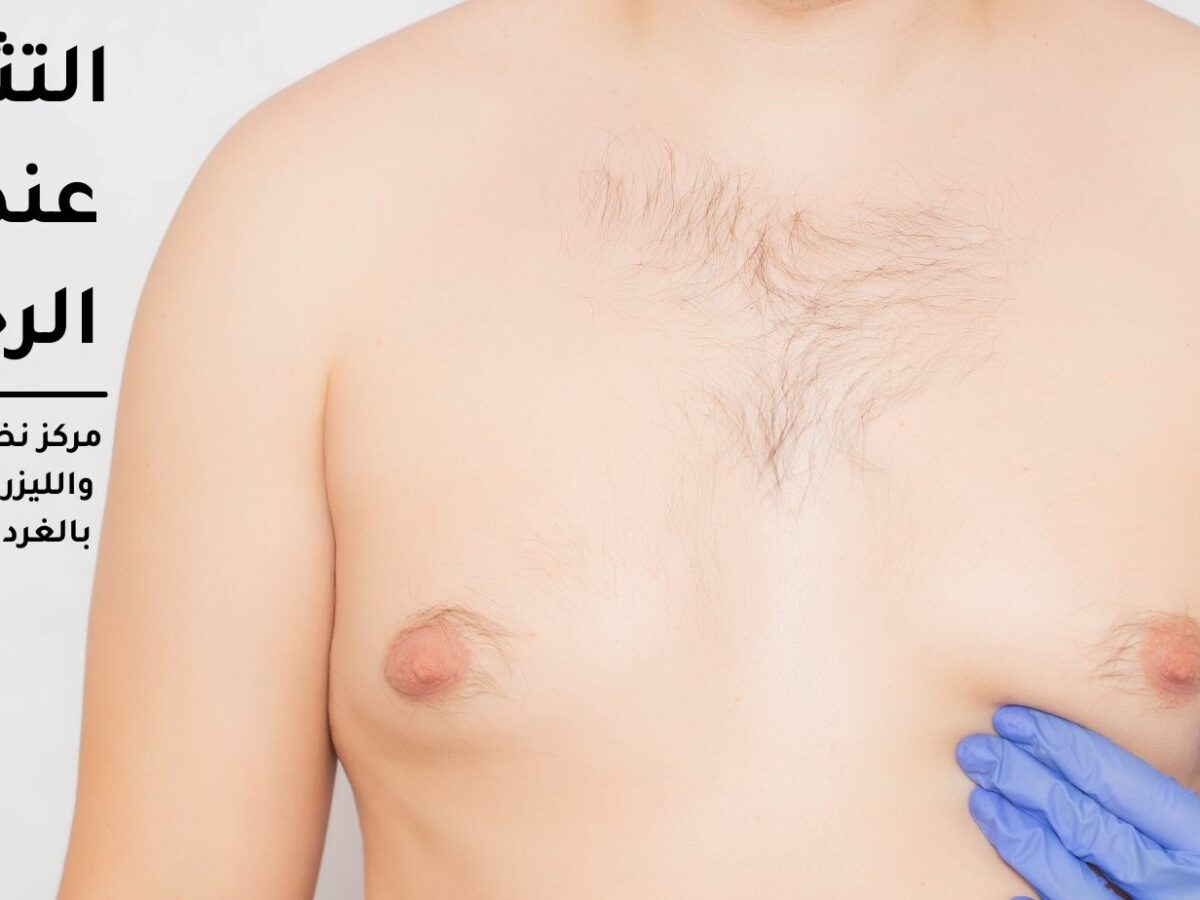 Gynecomastia in men, Causes and treatment