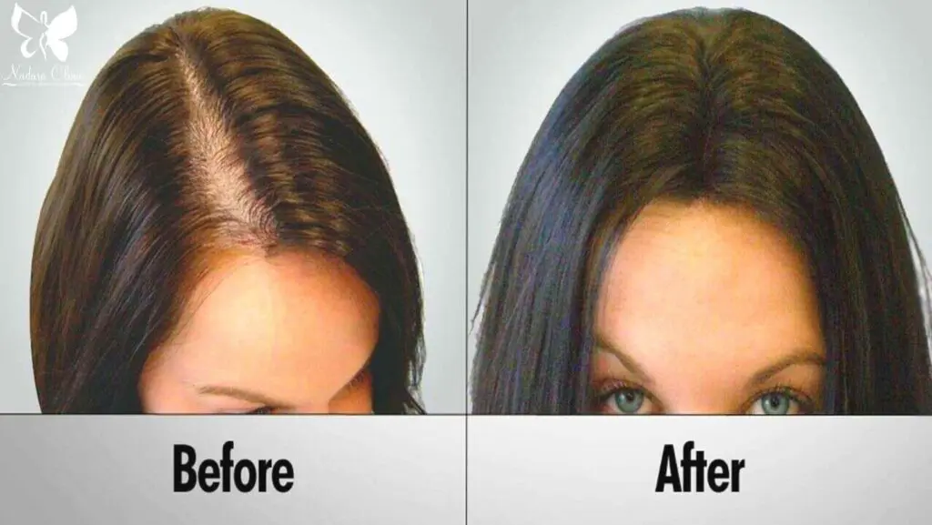hair growth treatment