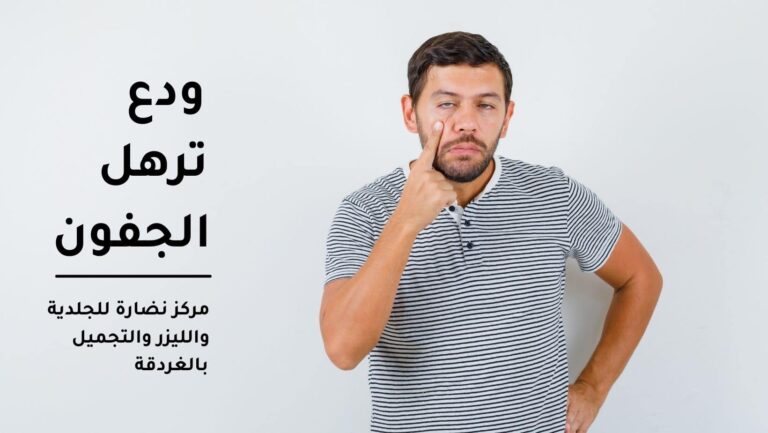 ودع ترهل الجفون