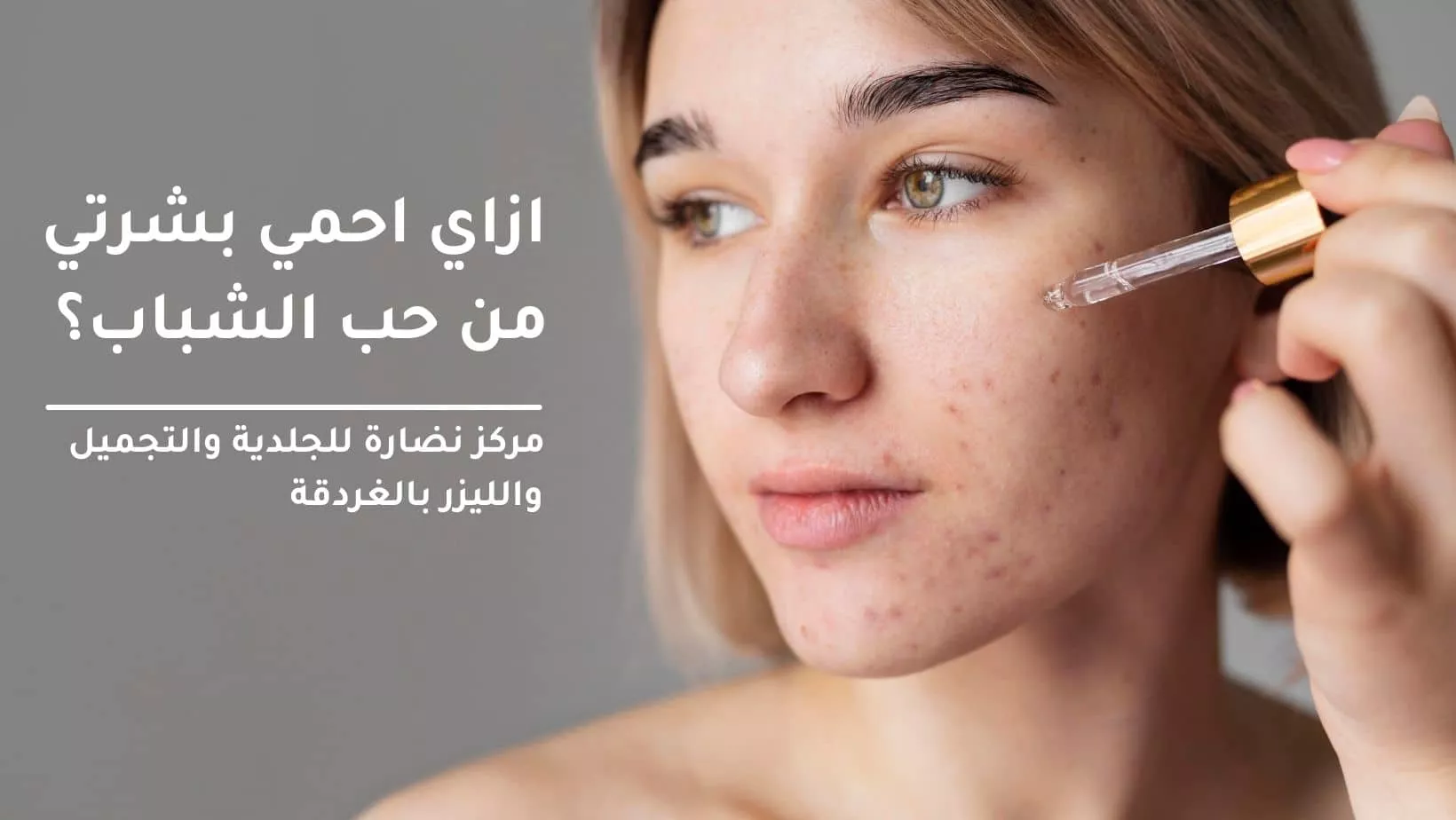 How do I protect my skin from acne?