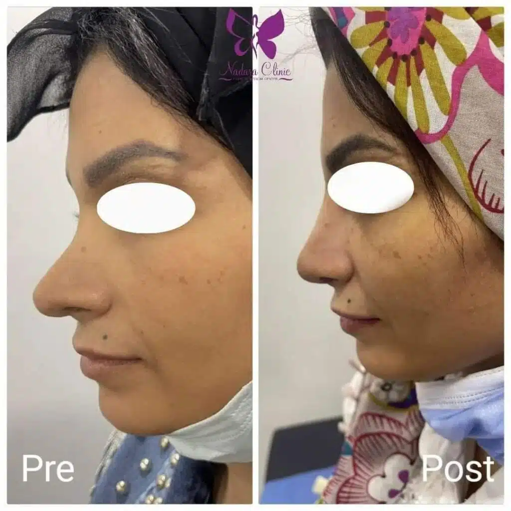 Coordination of facial features with the best surgeon