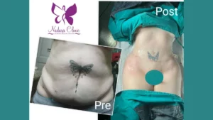 شفط الدهون في الغردقة مع افضل دكتور جلدية و أطباء طب الأمراض الجلدية