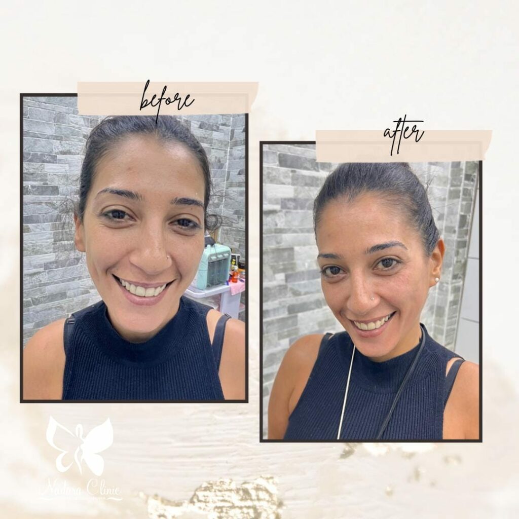 العناية بالبشرة جلسة تنظيف عميق