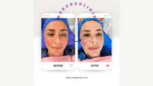 A beauty clinic in Hurghada and skin cleaning