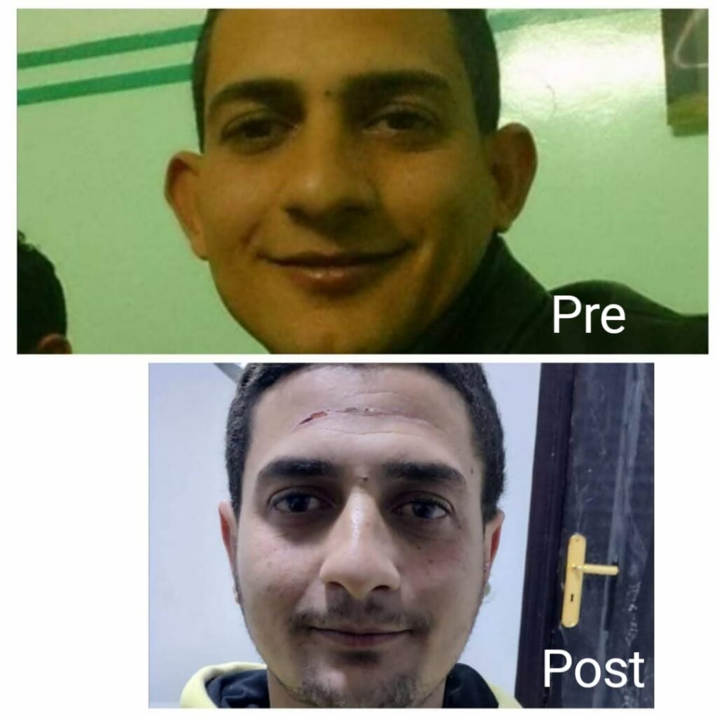 عملية تجميل الأذن في الغردقة