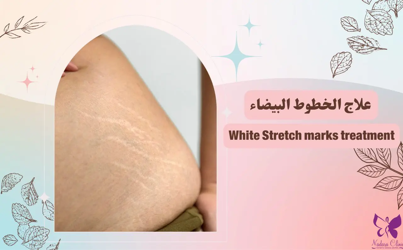 Stretch marks treatment in Hurghada