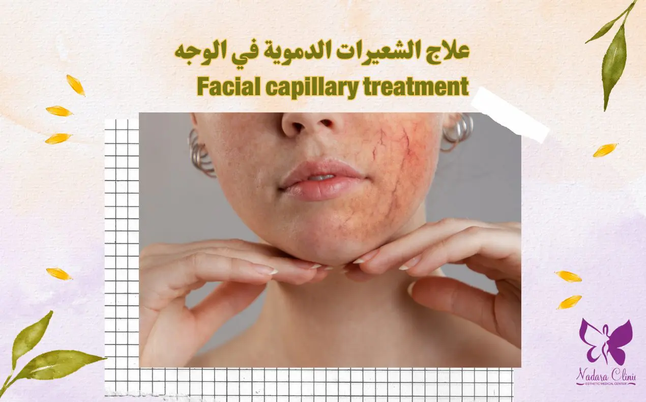 Facial capillary treatment in Hurghada
