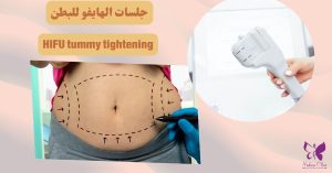 HIFU tummy tightening in Hurghada