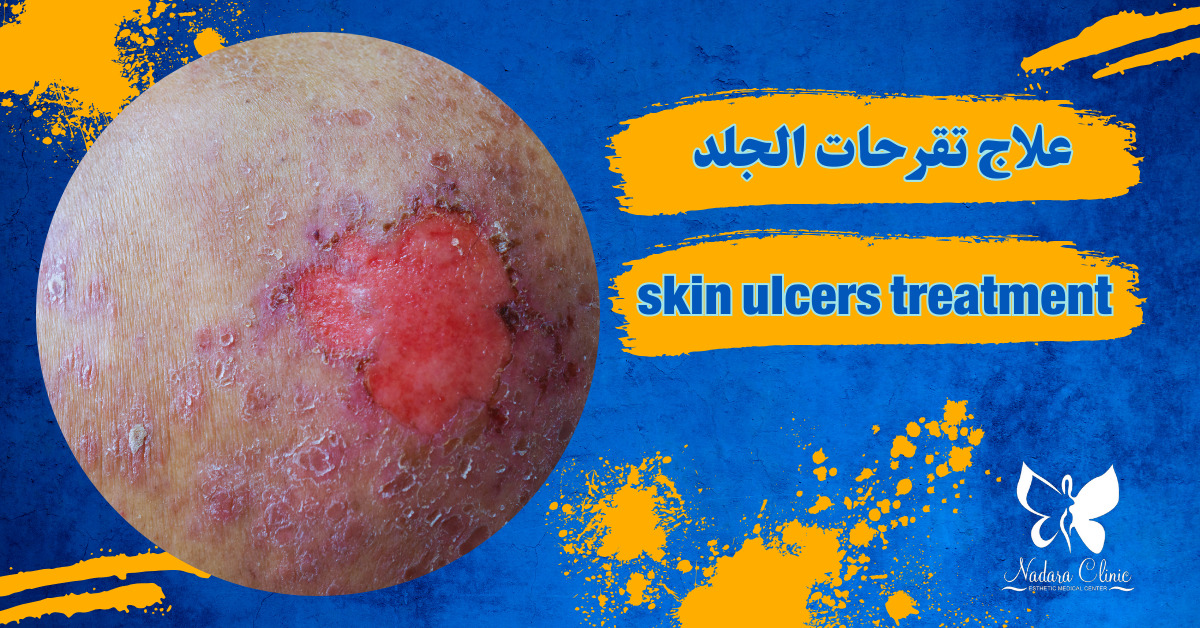 Skin ulcers treatment in Hurghada