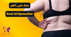 Back fat liposuction in Hurghada