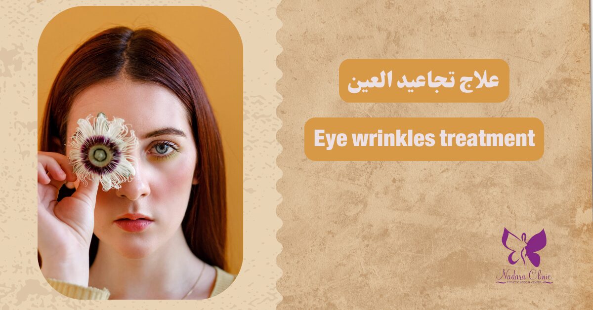 Eye wrinkles treatment in Hurghada
