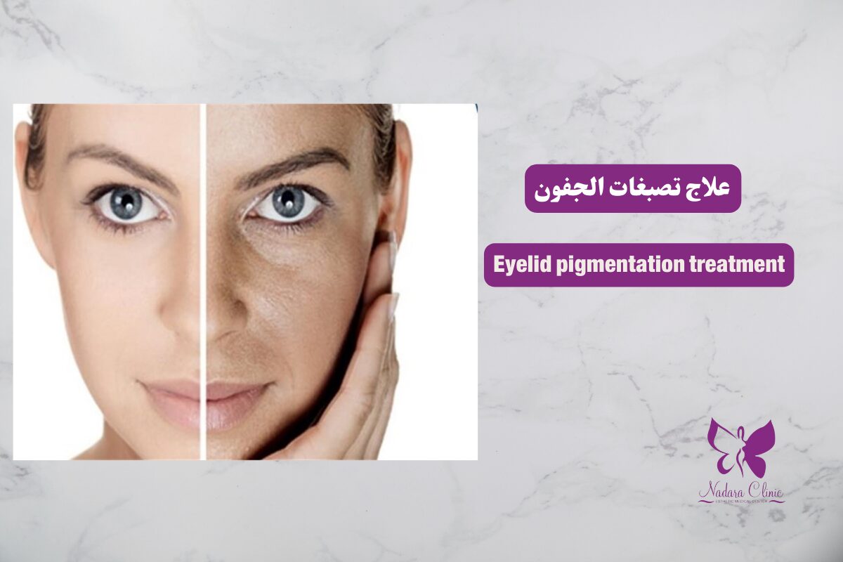 Eyelid pigmentation treatment in Hurghada