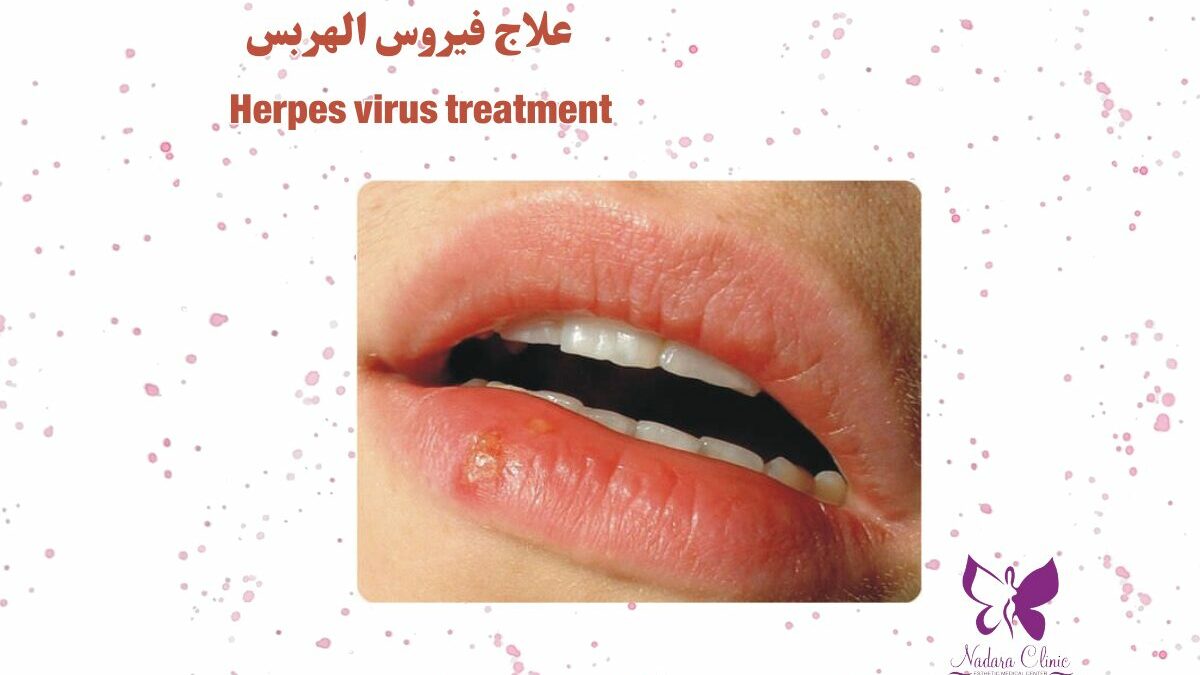 can you get herpes from a cigarette Hidradenitis Suppurativa vs Herpes: Photos, Symptoms, and More Vaping for just 12 months