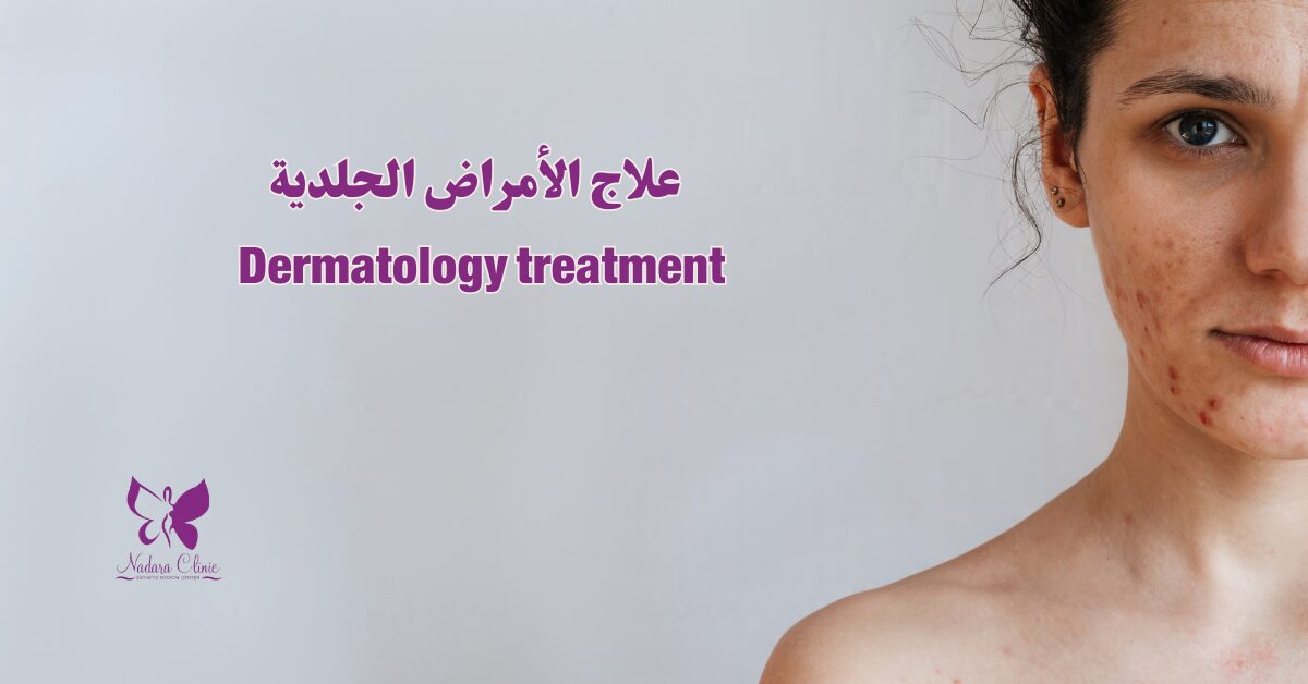 Dermatology treatment in Hurghada