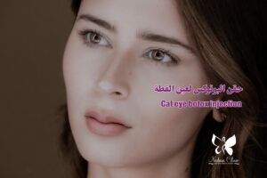 Cat eye botox injection in hurghada