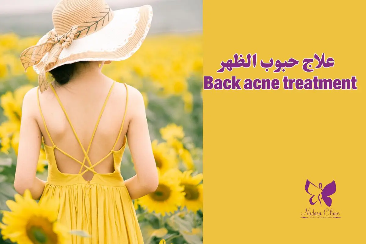 Back acne treatment in Hurghada