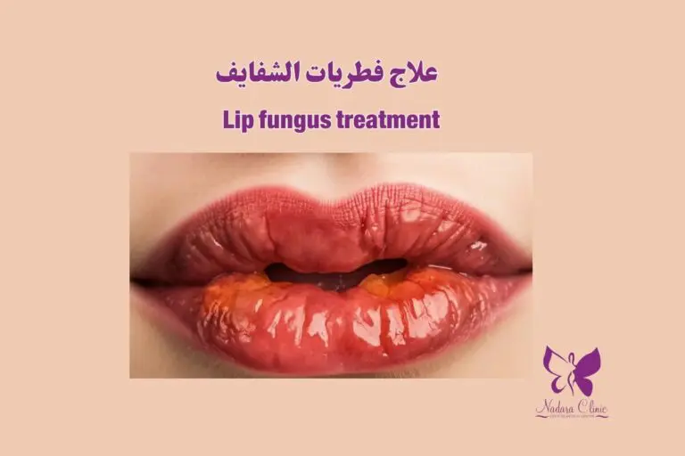 Lip fungus treatment in Hurghada