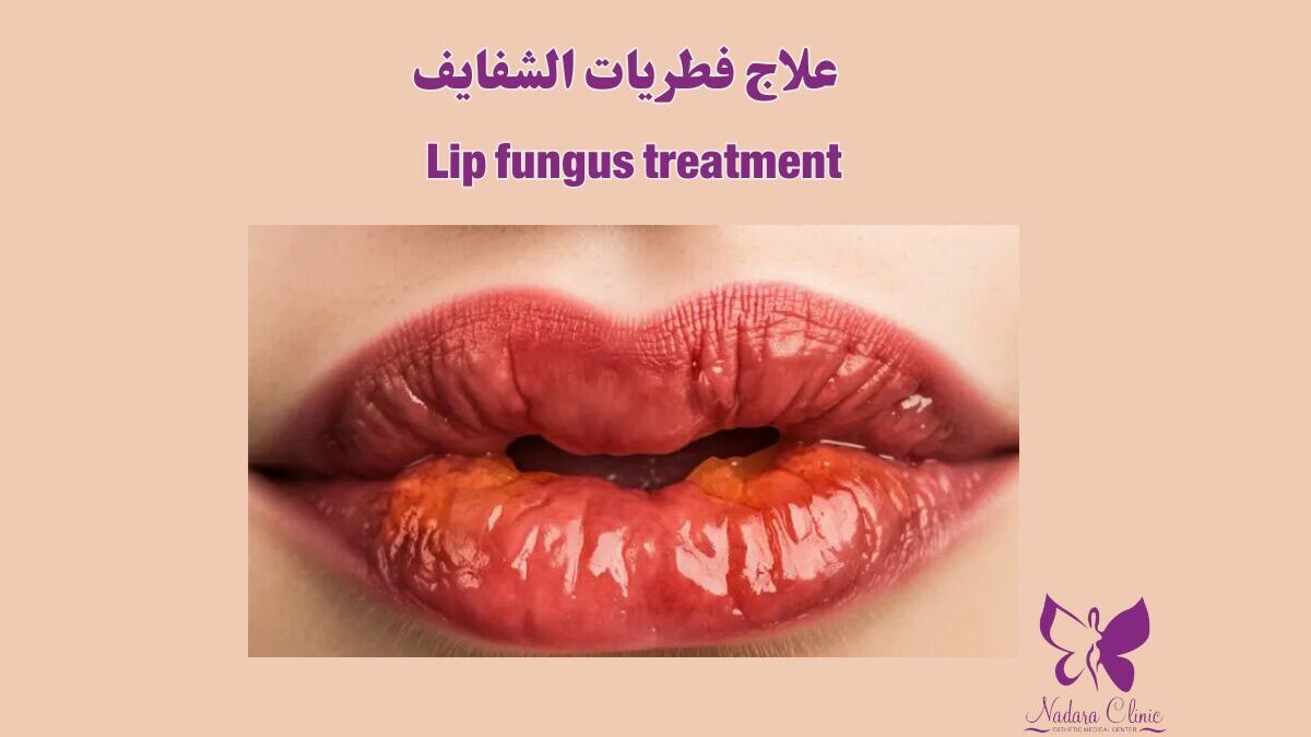 Antifungal creams for lips top