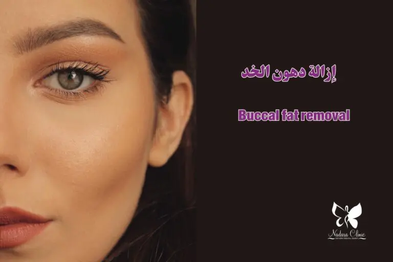 Buccal fat removal in Hurghada