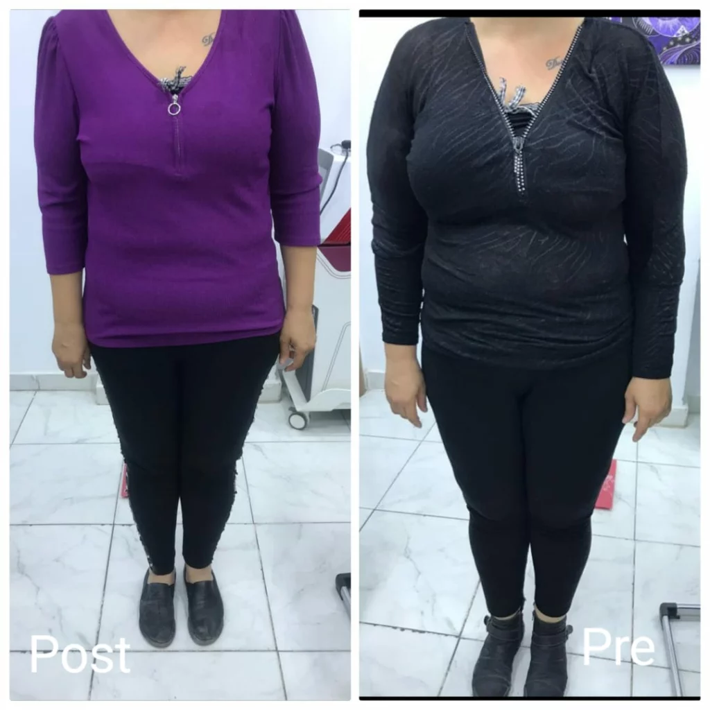 Lose 10 kg in 45 days
