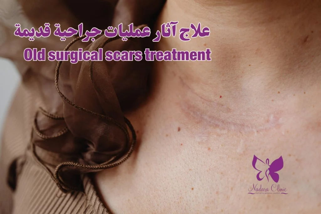 Old surgical scars treatment in Hurghada