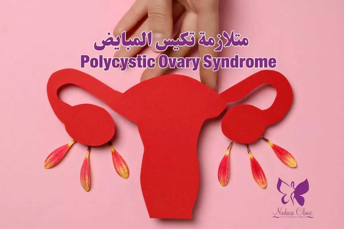 متلازمة تكيس المبايض في الغردقة