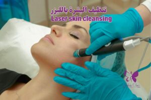 Laser skin cleaning in Hurghada