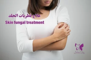 علاج فطريات الجلد في الغردقة