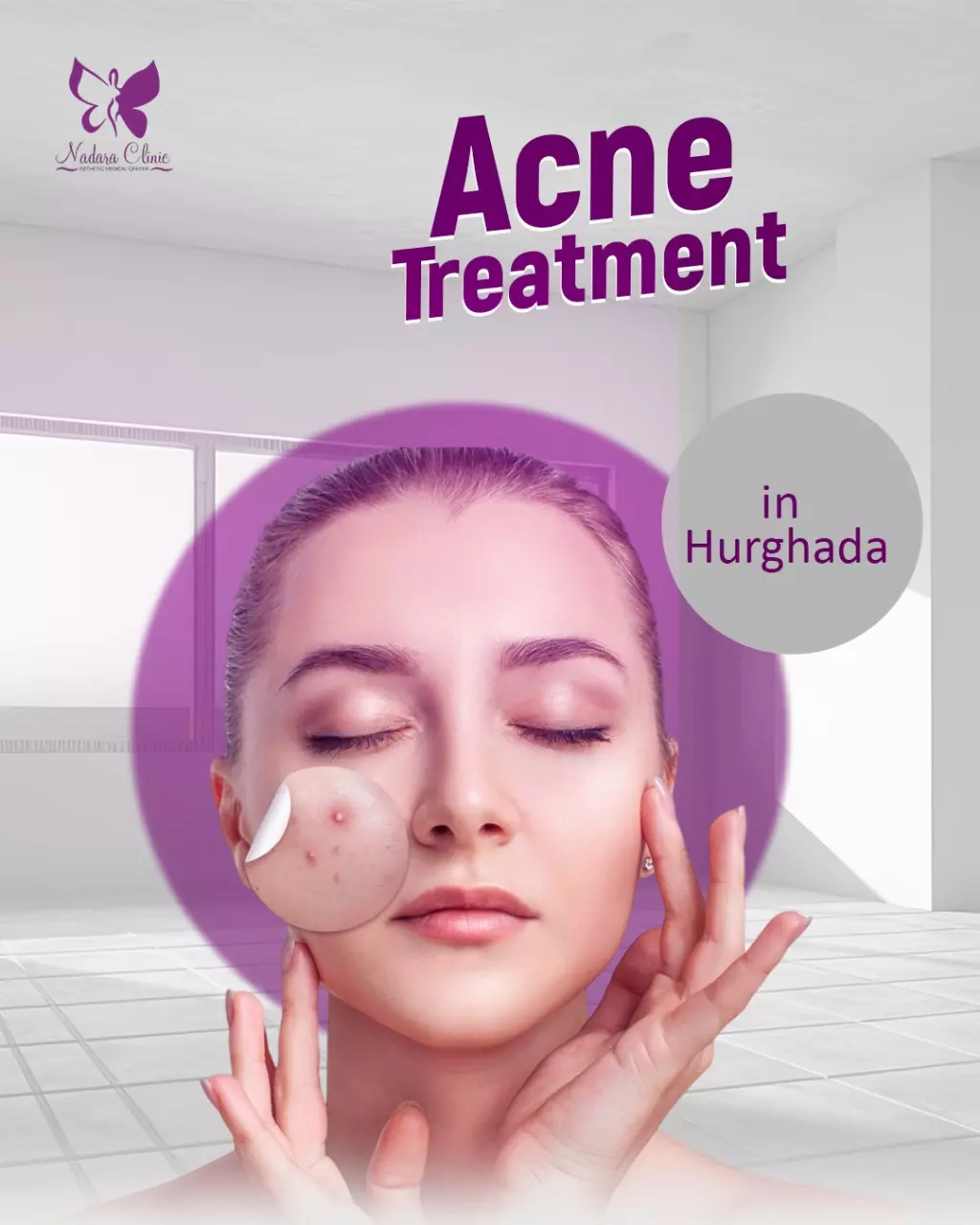 Acne treatment in Hurghada