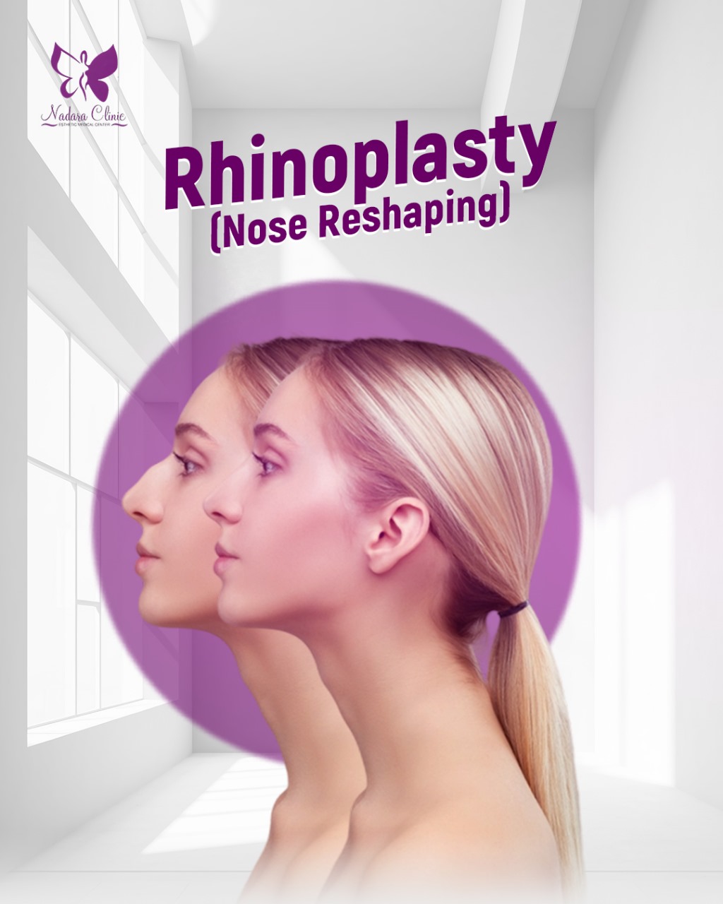 Rhinoplasty