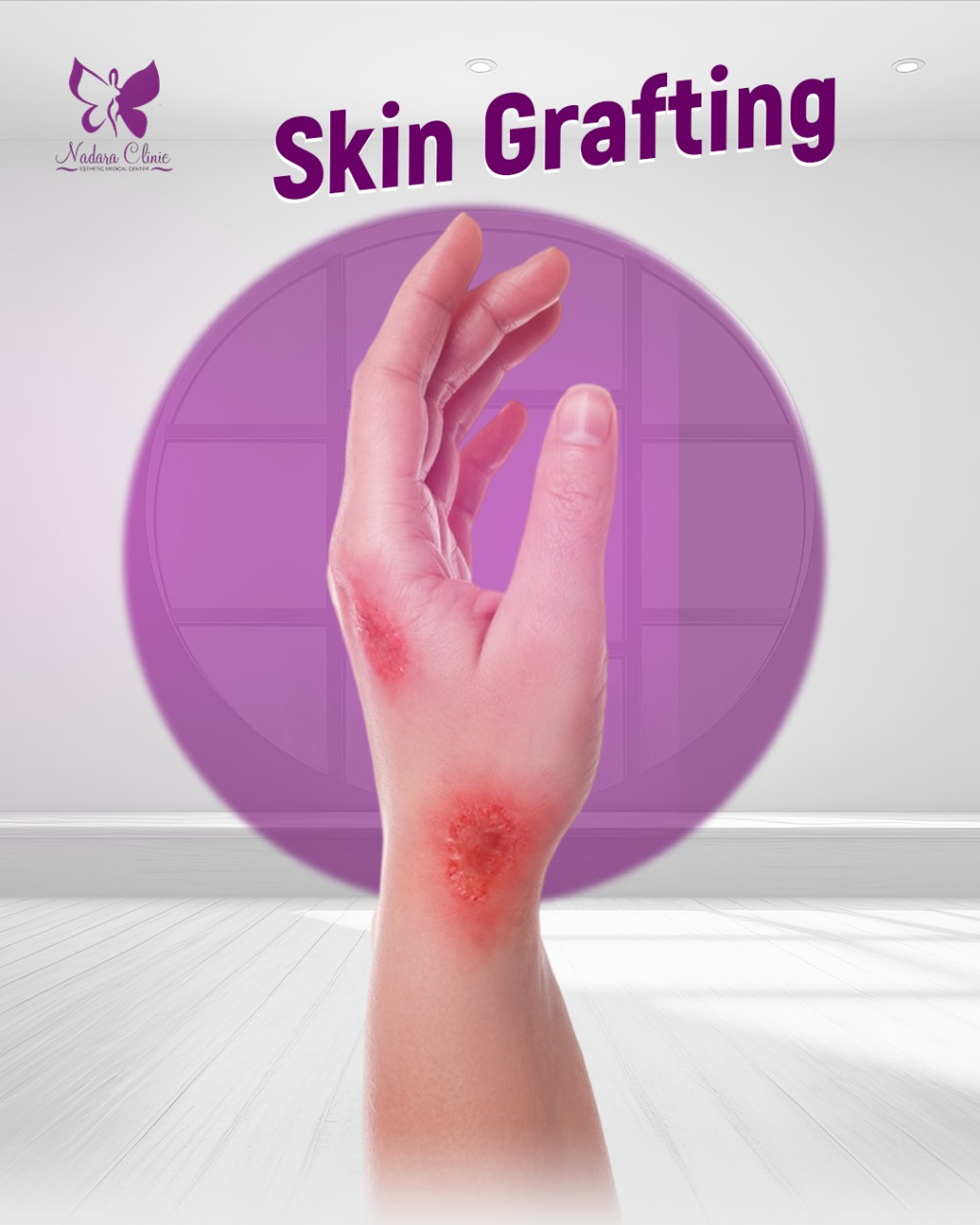 skin patch