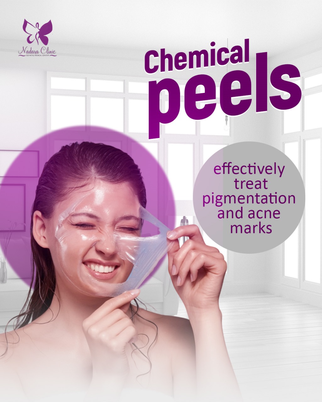 chemical peeling