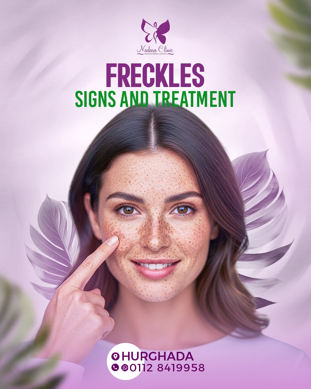 Freckles and their treatment in Hurghada